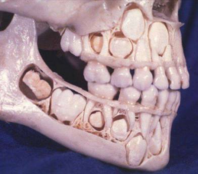 9. A Child's Skull Before                                         Losing Baby Teeth...