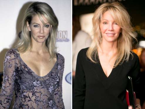 Heather Locklear ( 1996 and 2015)